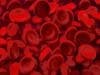 FDA Approves Longer Lasting New Treatment for Hemophilia A
