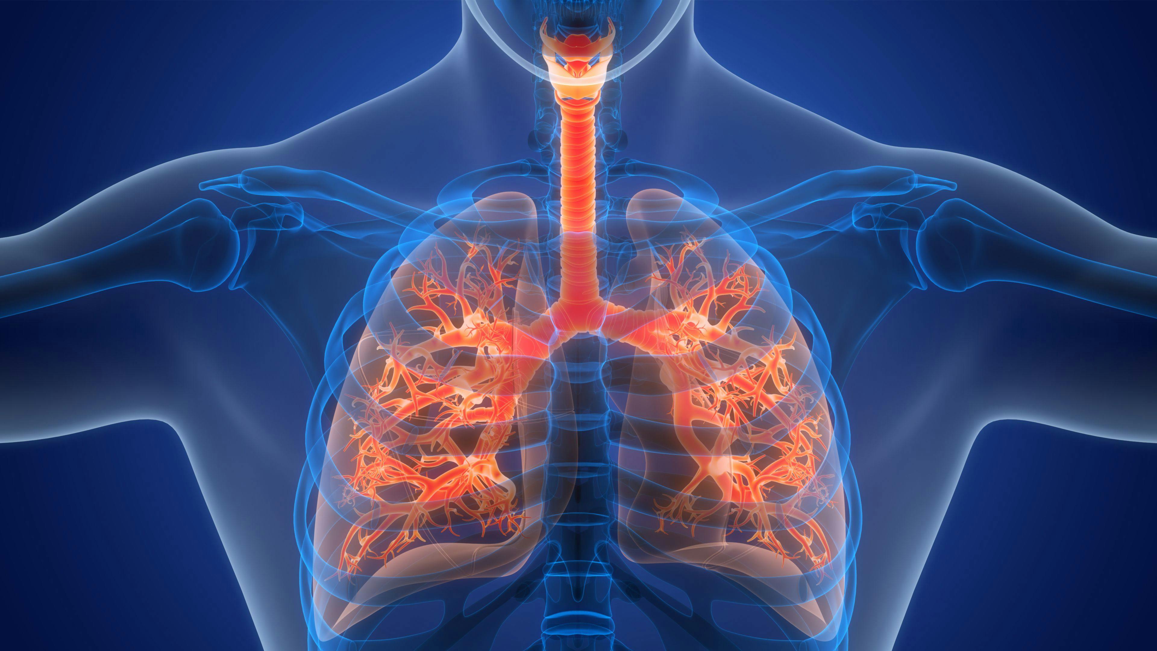 X-ray of lungs with asthma -- Image credit: magicmine | stock.adobe.com