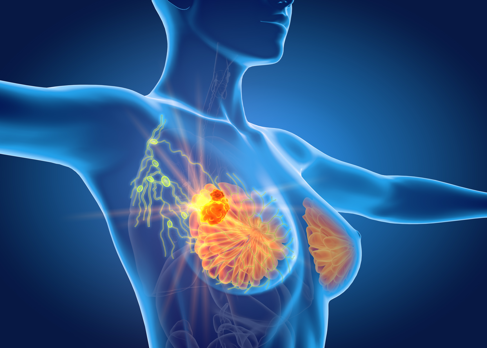 New Targets for Treatment of Triple-Negative Breast Cancer Discovered