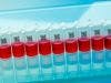 Experimental Ebola Vaccine Ready to Begin Human Trials 
