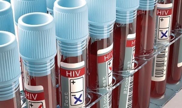 Pre-exposure Prophylaxis Found to Lower HIV Anxiety Among MSM