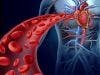 Rheumatoid Arthritis Linked to Heart Disease Risk