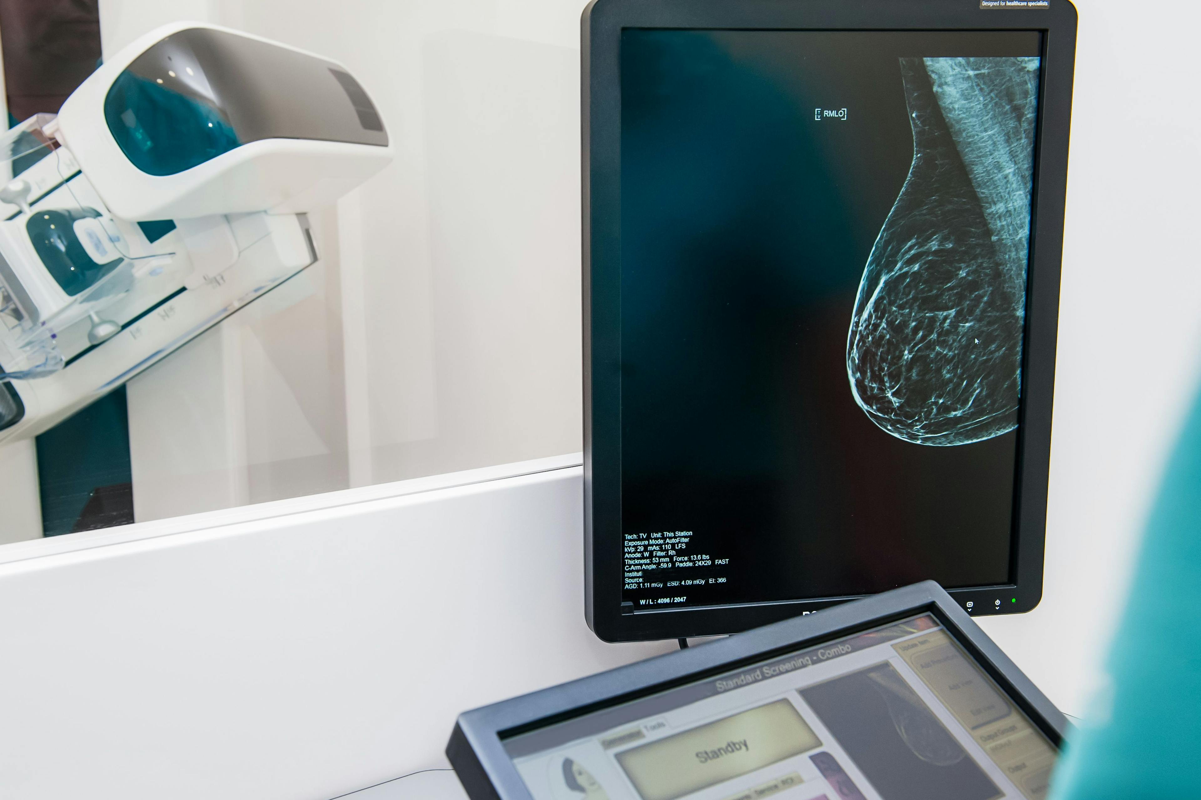 Physician overseeing a mammography