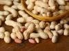 Using Artificial Intelligence to Change the Design of a Peanut Protein Can Help Patients Overcome Severe Allergies