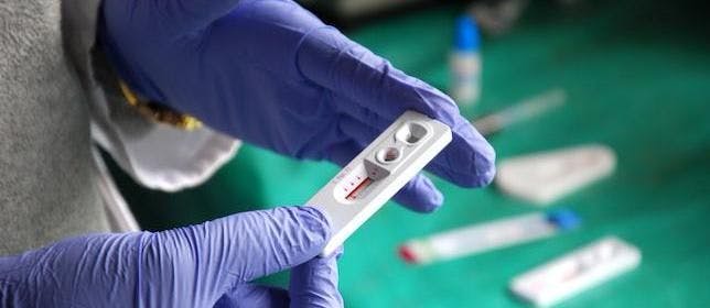 Study: Older Adults, Hispanics Less Likely to Receive HIV Testing
