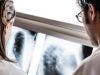 Early Lung Cancer Treatment Affected by Race, Insurance Status