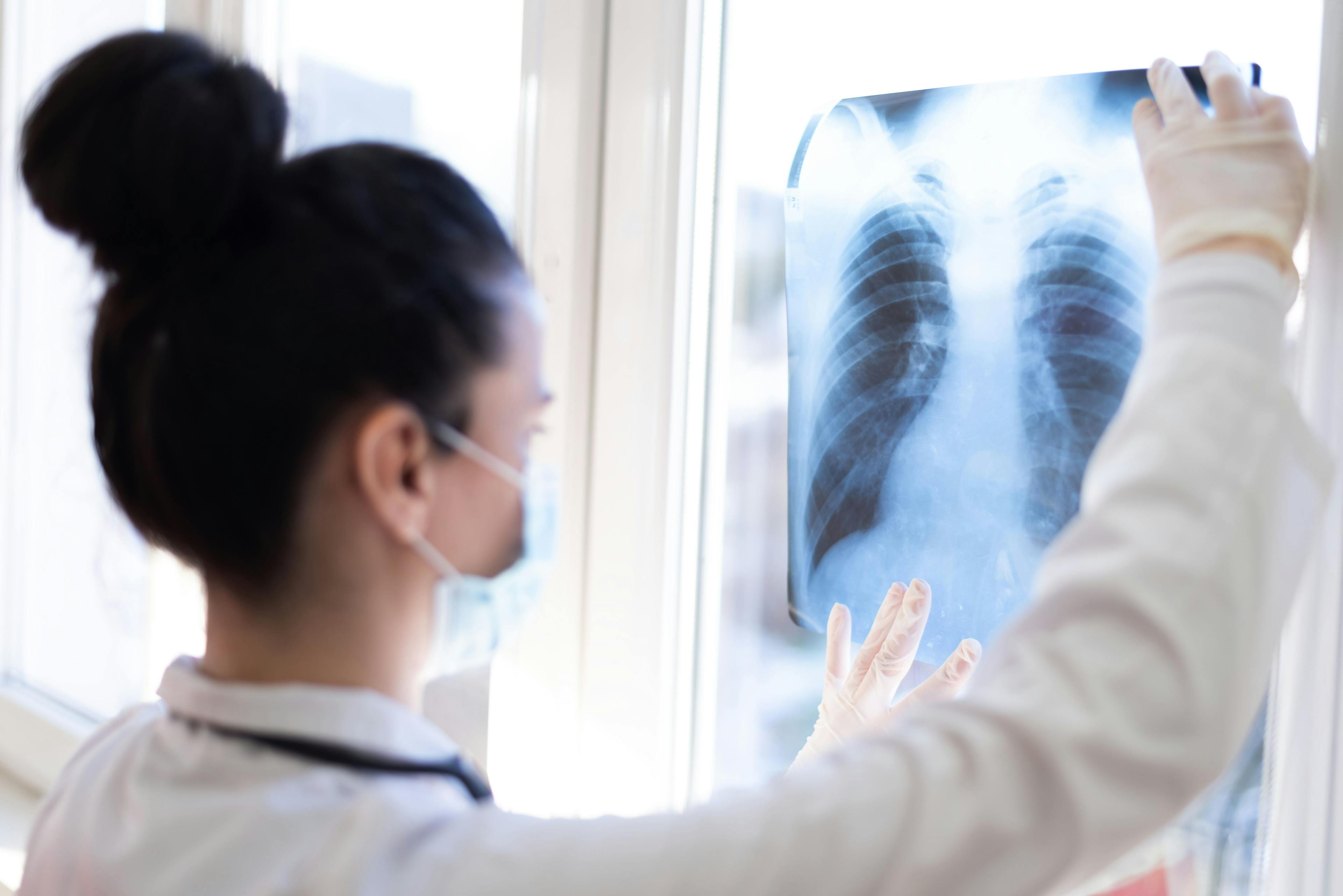 Health care worker looking at lung x-ray