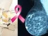 Drug Combination Overcomes Chemotherapy Resistance in Triple Negative Breast Cancer 
