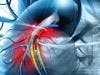 Monoclonal Antibody Lowers Risk of Cardiovascular Events