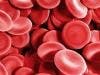 Diabetes and Other Comorbidities Could Greatly Hurt Platelet Function