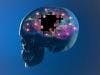 Alzheimer Disease Risk Linked to Use of Benzodiazepines, Related Z-drugs