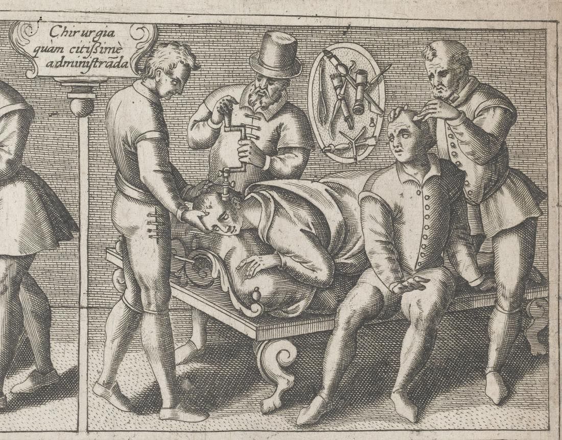 Pharmacy Fact: On Trepanning and Holey Heads for the Sake of Medicine
