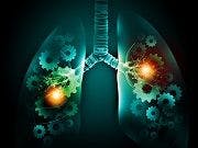 Severe Asthma Drug Meets Primary Endpoint in Phase 3 Trial
