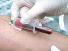 New Blood Test Can Now Track Melanoma