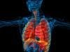 Examining Pulmonary Manifestations of IBD