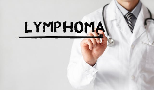 Doctor writing word Lymphoma with marker, Medical concept | Image Credit: MP Studio - stock.adobe.com