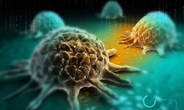 Combination Therapy Not Found to Improve Progression-Free Survival in Ovarian Cancer