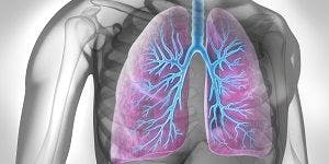 First-Ever Guideline for Preventing Acute COPD Exacerbations