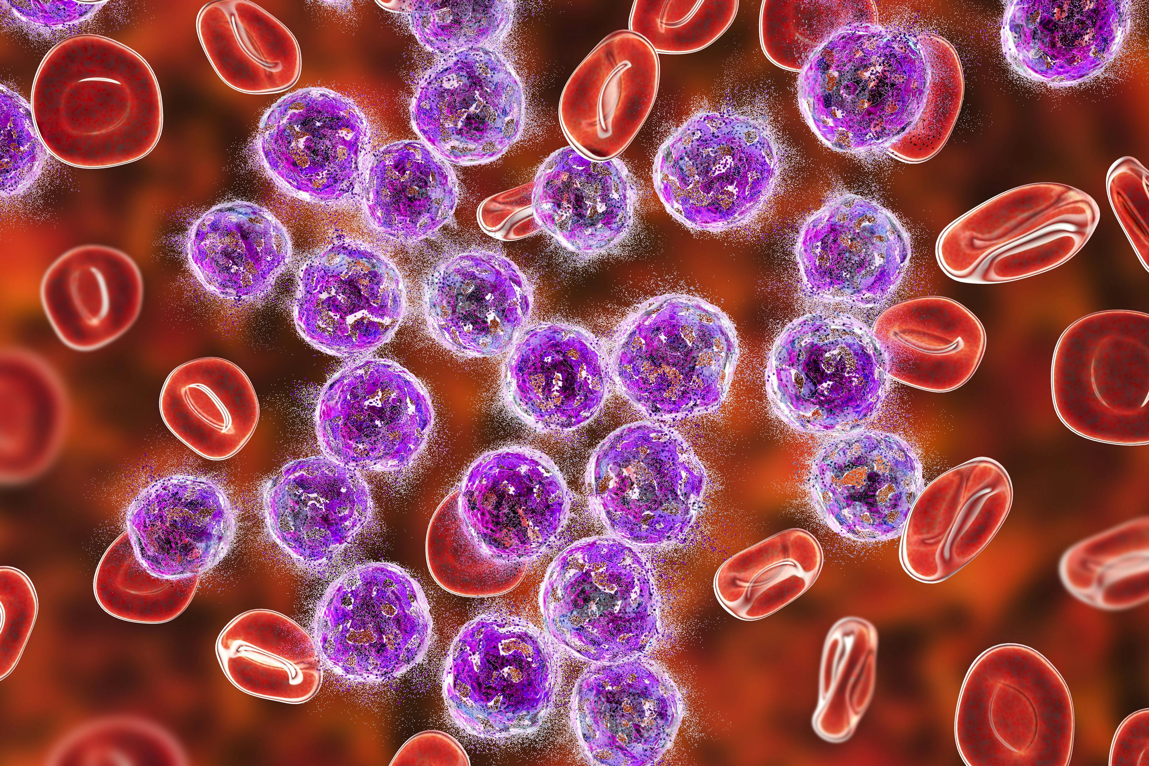 COVID-19 Mortality, Hospitalization Risk Higher in Patients With Blood Cancers