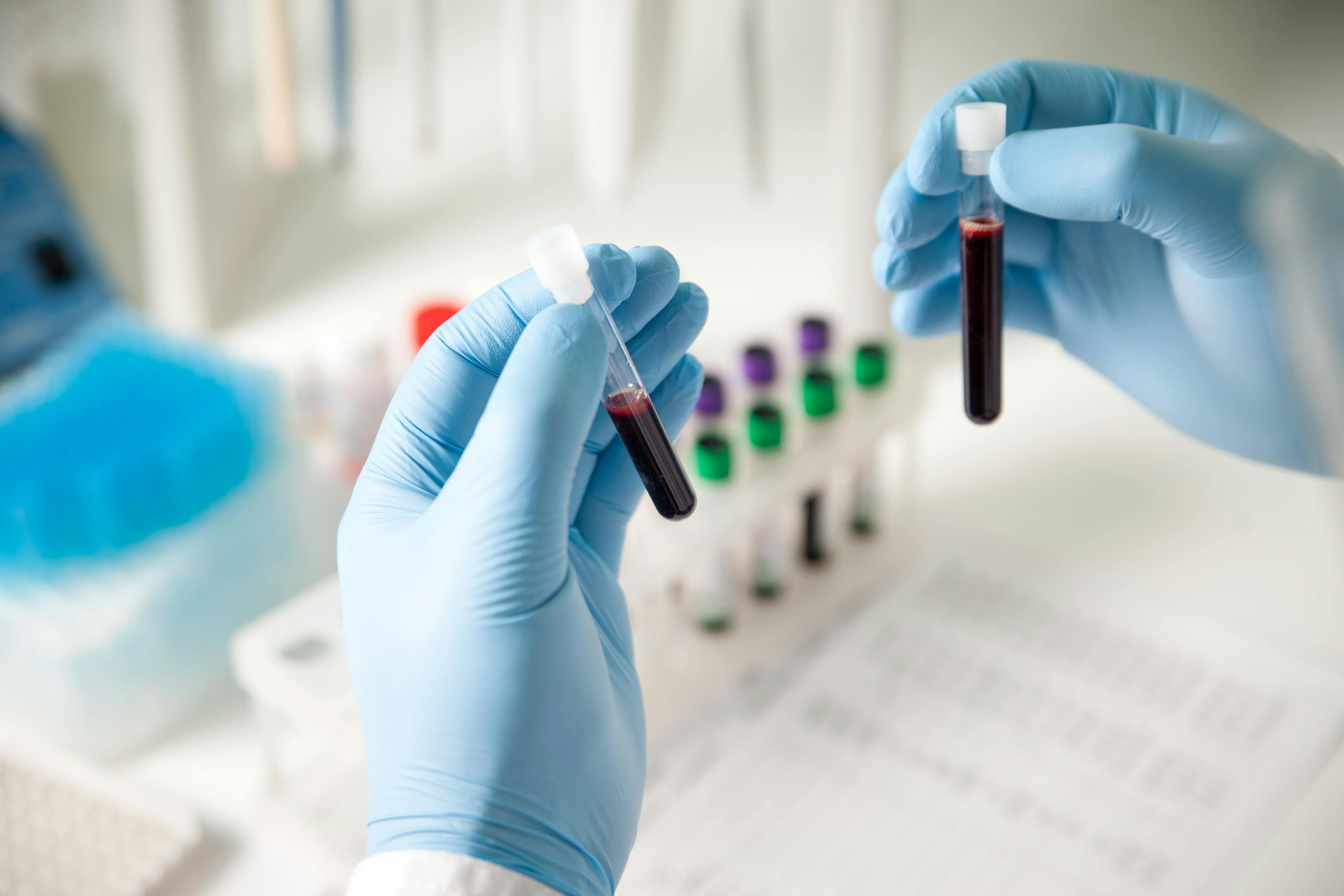 Lab tech testing blood samples