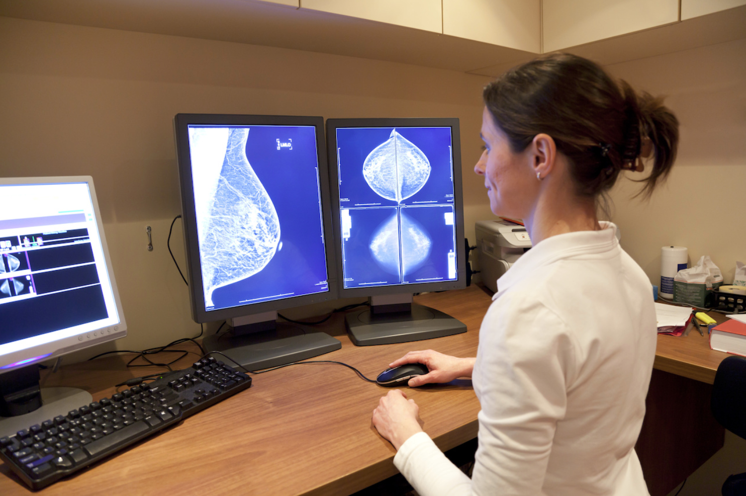 Mammography Screening Rates on the Decline Since 2009 Among Breast Cancer Survivors