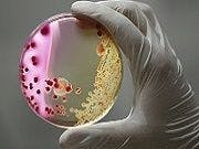Trending News Today: Rare Superbug Fungus May Be Spreading