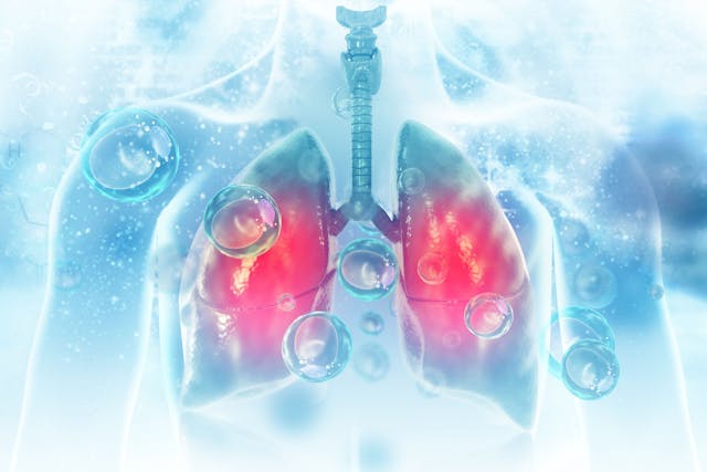 Virus and bacteria infected the Human lungs | Image Credit: Crystal light - stock.adobe.com