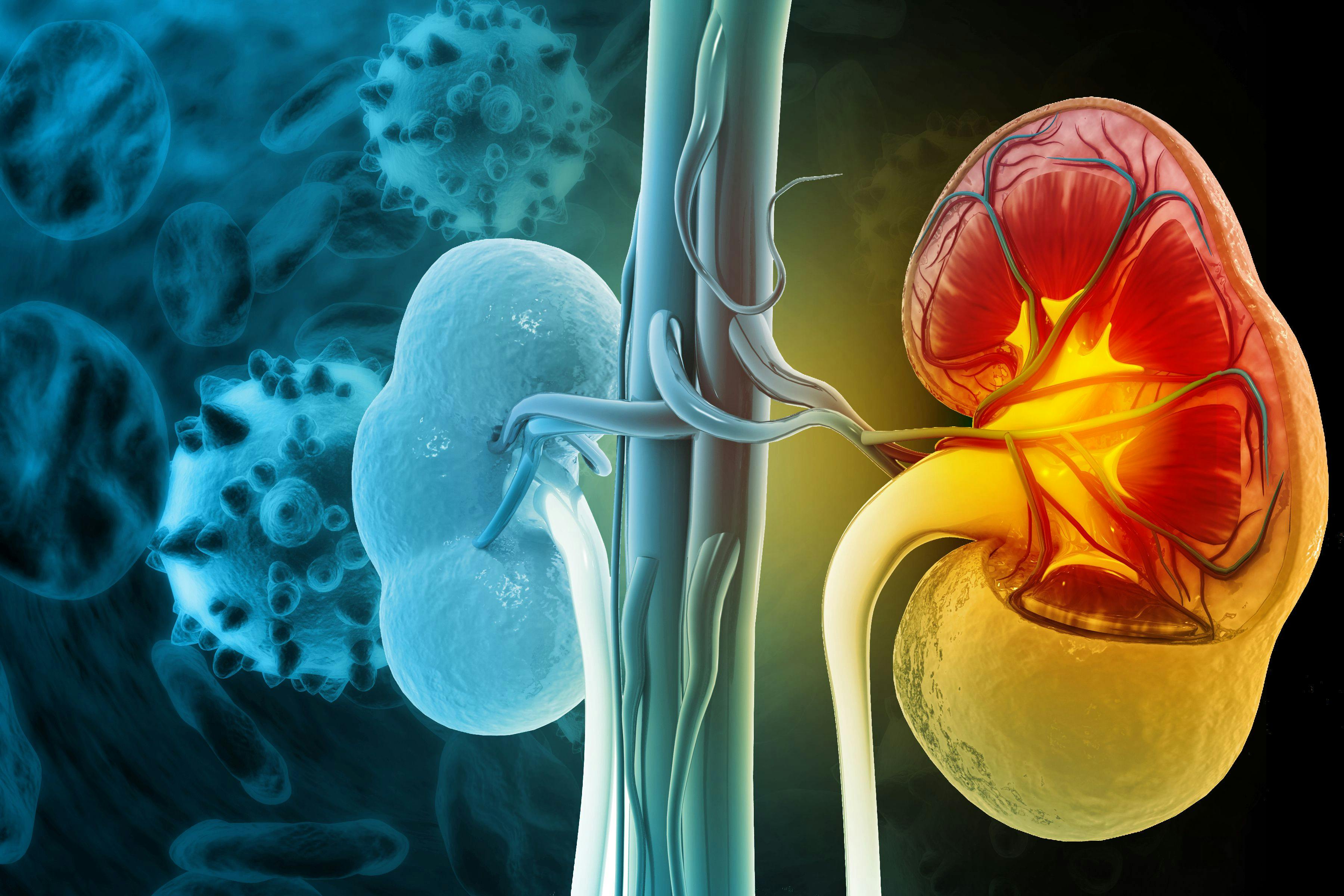 Chronic kidney disease. 3d illustration | Image Credit: Crystal light - stock.adobe.com