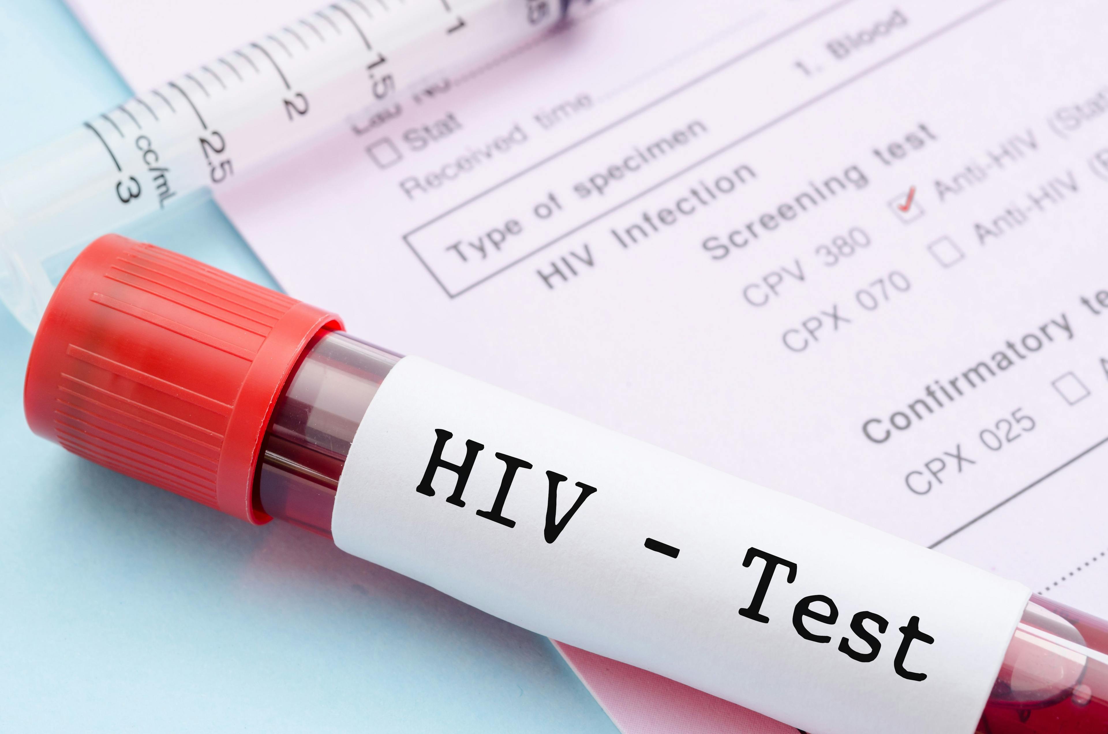 Study: Individuals With HIV Have Higher Risk of Depression, Suicide