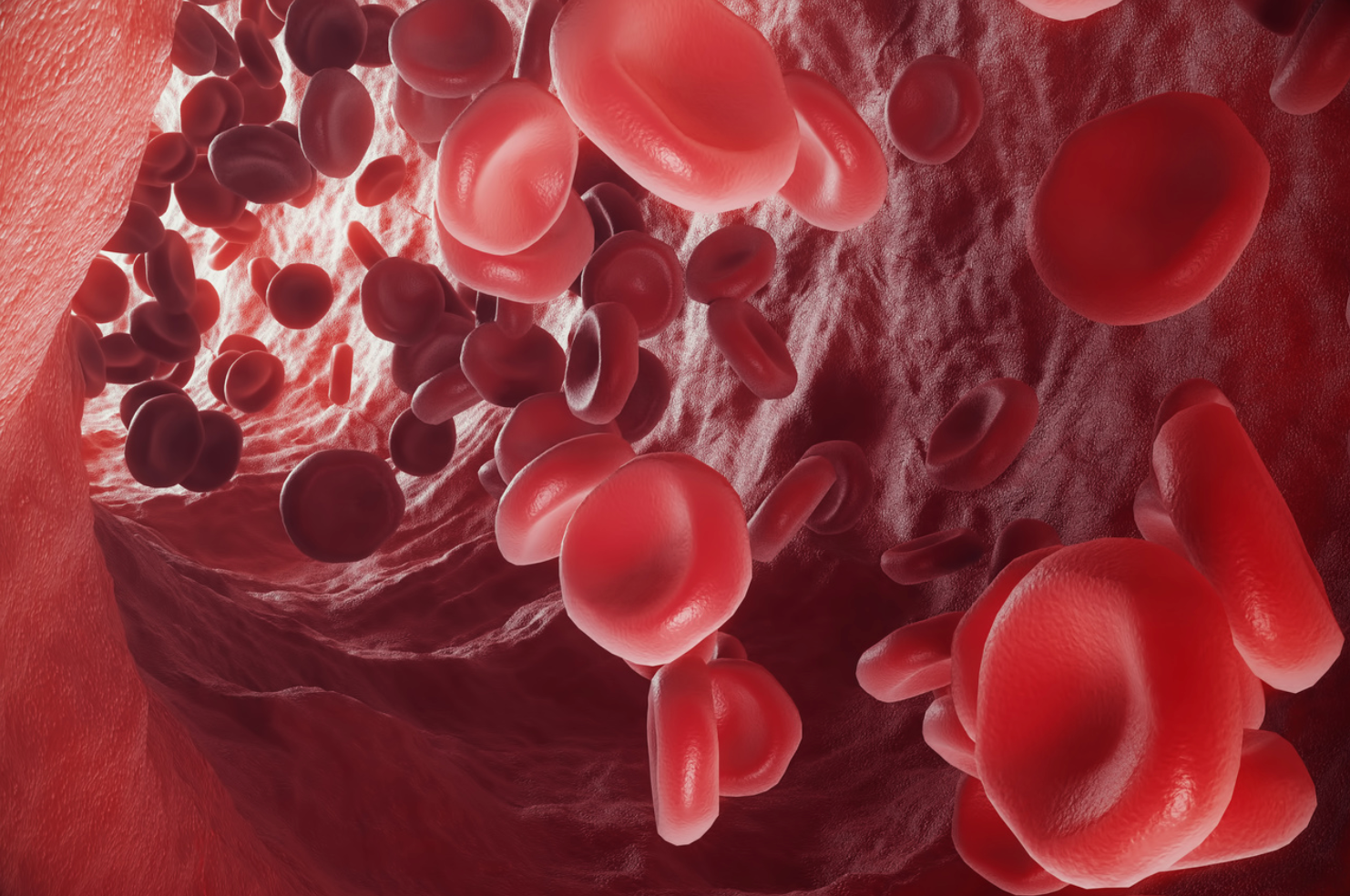 Data Show Rivaroxaban Lowers Severe Vascular Event Risk in Patients With PAD
