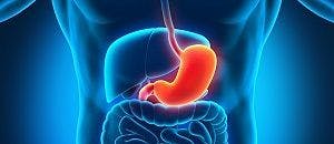 Irritable Bowel Syndrome: Getting to Know This Group of Symptoms