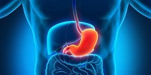 A New Frontier in GERD: The Gastric Pocket