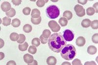 Study: New Target for Treating Chronic Myeloid Leukemia Found