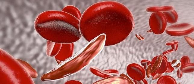 Breakthrough Therapy Designation Granted for Sickle Cell Disease Treatment