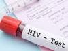 Older Adults, Hispanics Less Likely to Receive HIV Testing