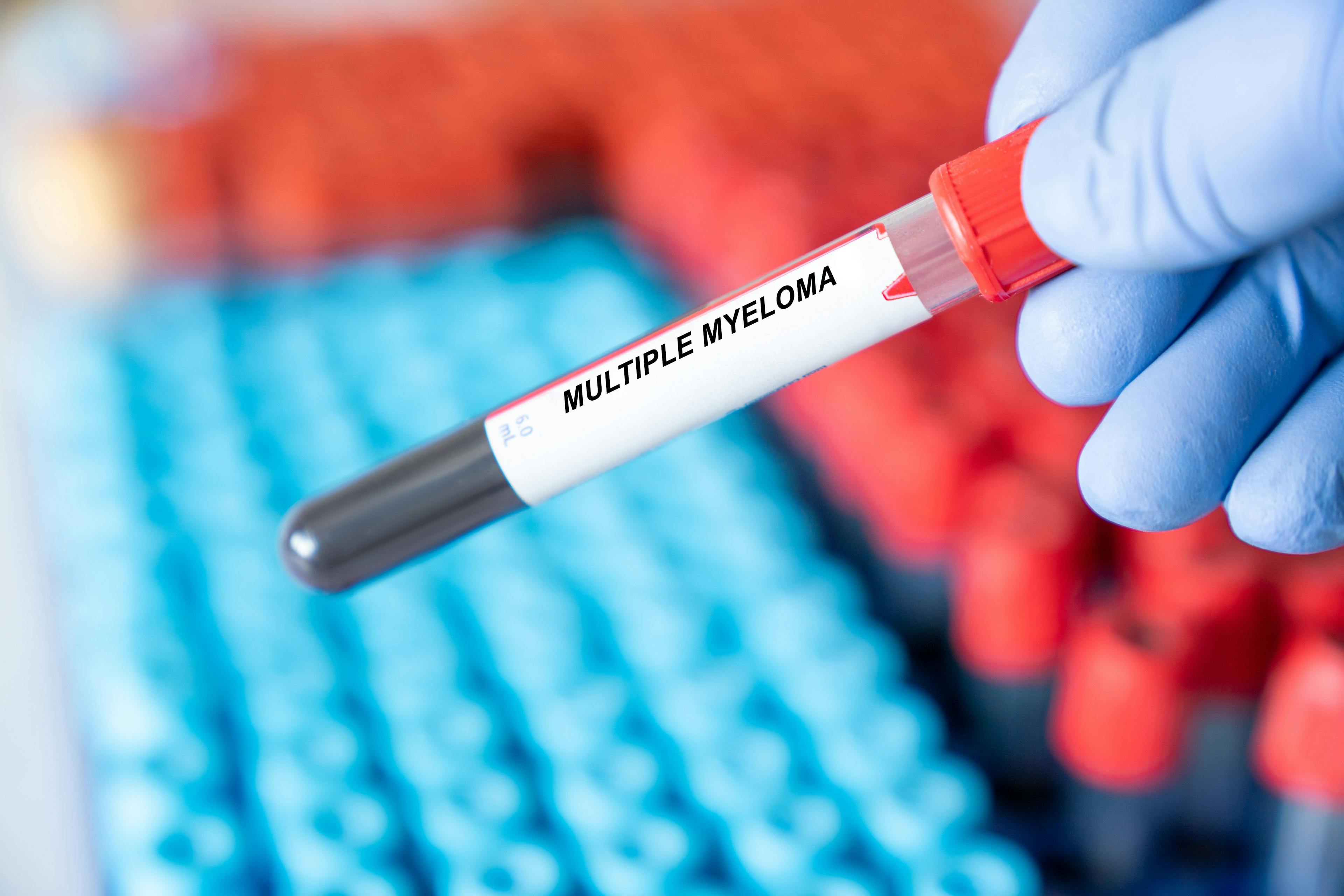 Multiple Myeloma. Multiple Myeloma disease blood test in medical laboratory | Image Credit: luchschenF - stock.adobe.com