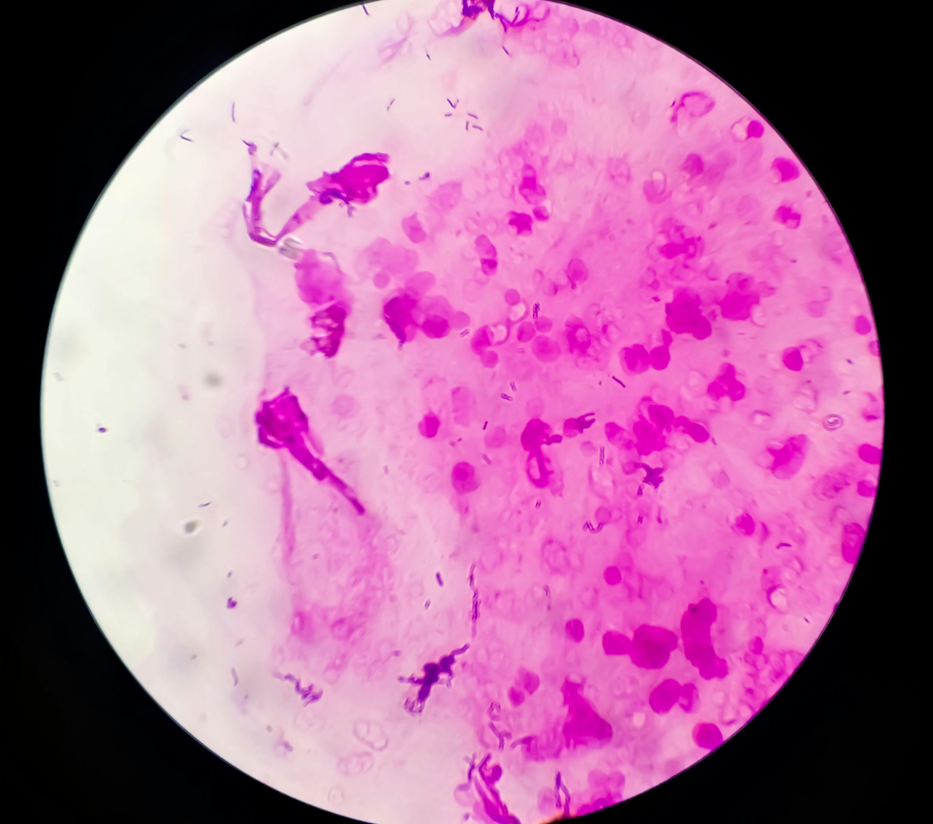 Microscopic view of s aureus bacteria -- Image credit: Arif Biswas | stock.adobe.com