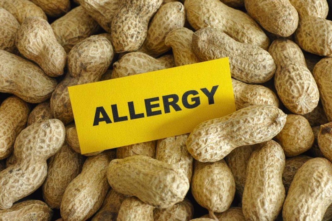 Clinical Insights: Palforzia is the First FDA-approved Treatment of Peanut Allergy