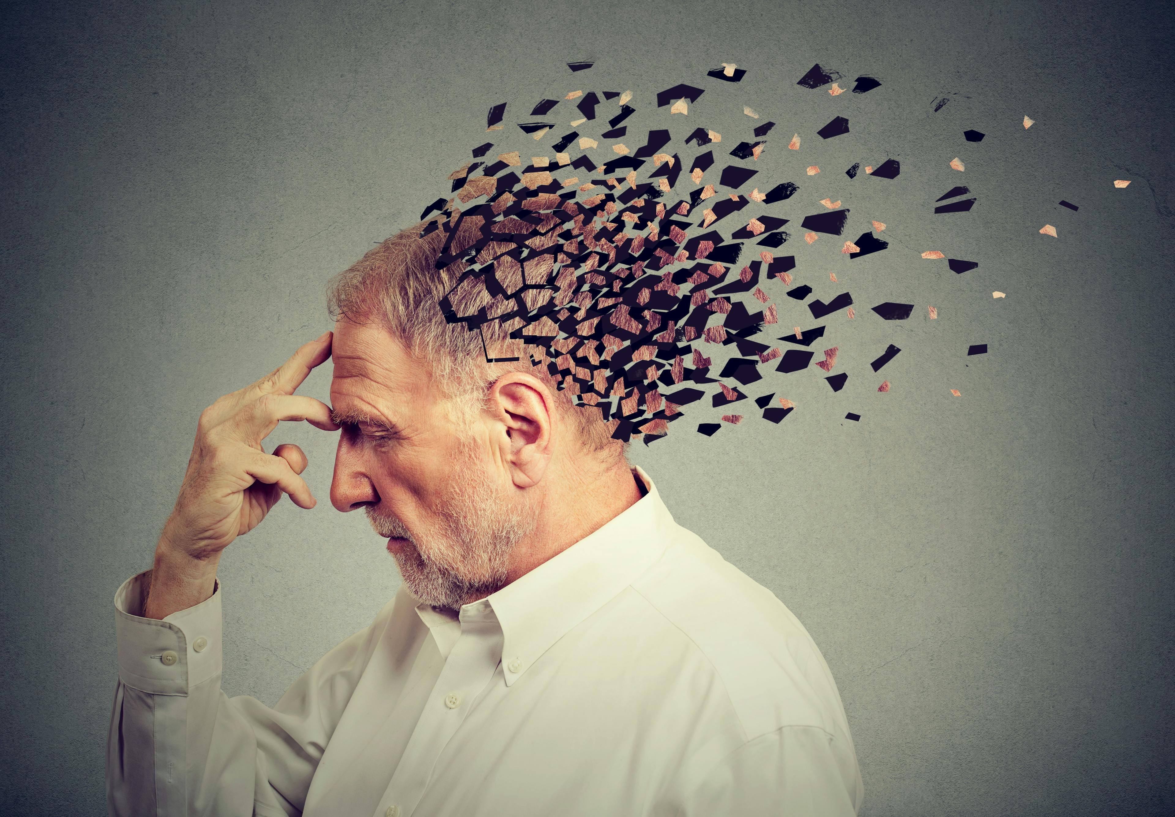 Memory loss due to dementia. Senior man losing parts of head as symbol of decreased mind function. | Image Credit: pathdoc - stock.adobe.com