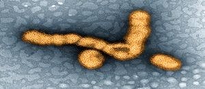 CDC: Flu Season at Peak, Epidemic Levels