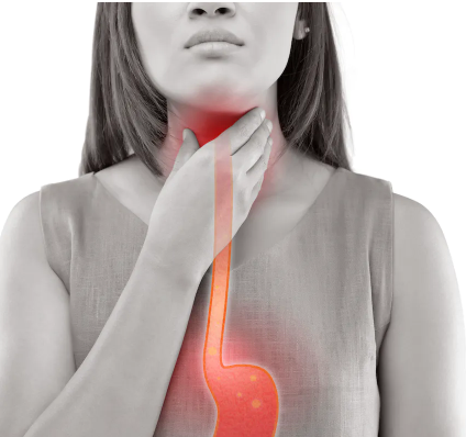 Guide Patients to Appropriate Treatments for Dyspepsia, Heartburn