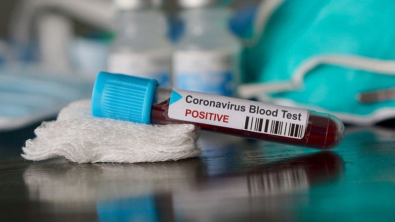 Study: One-Third of Caregivers of Children With Cancer Are Hesitant About COVID-19 Vaccine