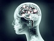 Brain Glucose Levels Drop in Patients with Obesity, Diabetes