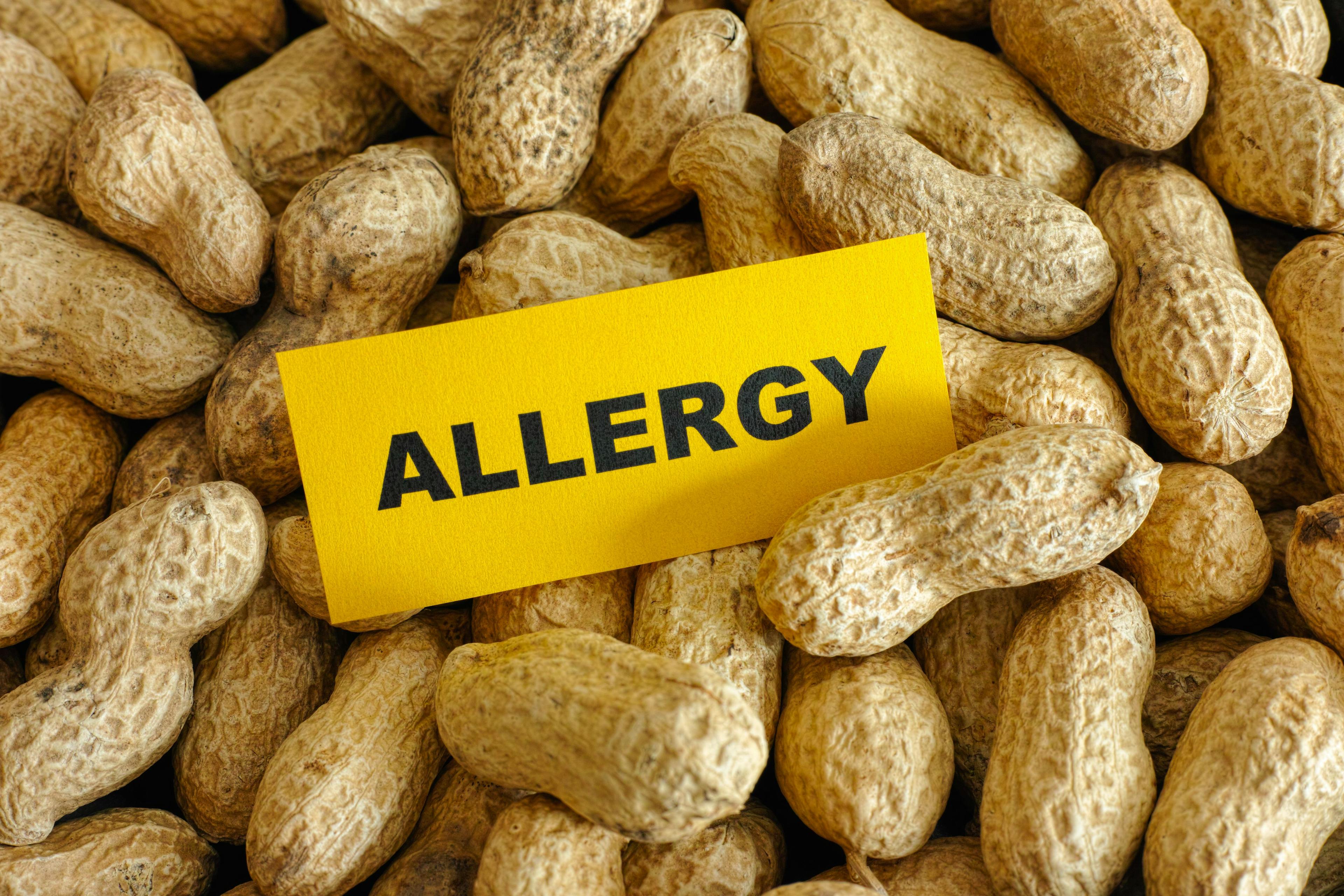 Peanut allergy -- Image credit: Stepan Popov | stock.adobe.com