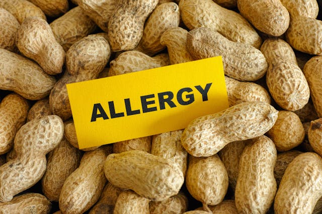 Peanut allergy -- Image credit: Stepan Popov | stock.adobe.com