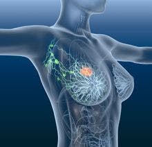Oral Oncolytics Expand Armamentarium in HR+/HER– Early-Stage Breast Cancer in Adjuvant Setting