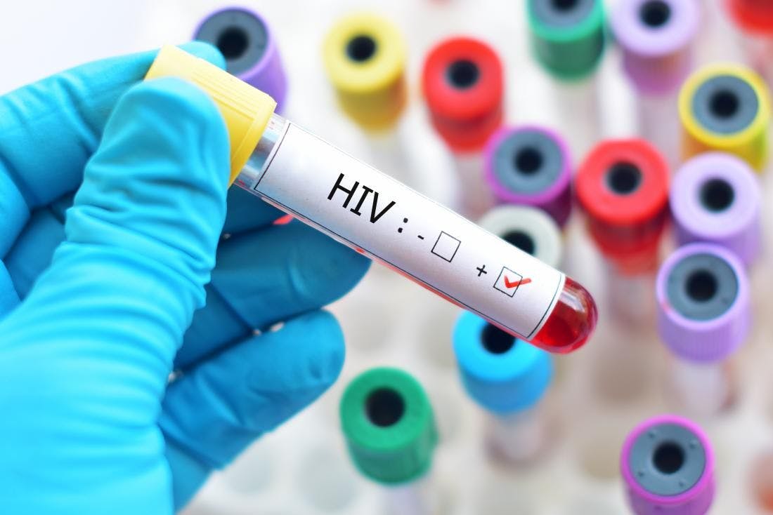 Study: People With HIV at Increased Risk for Heart Failure