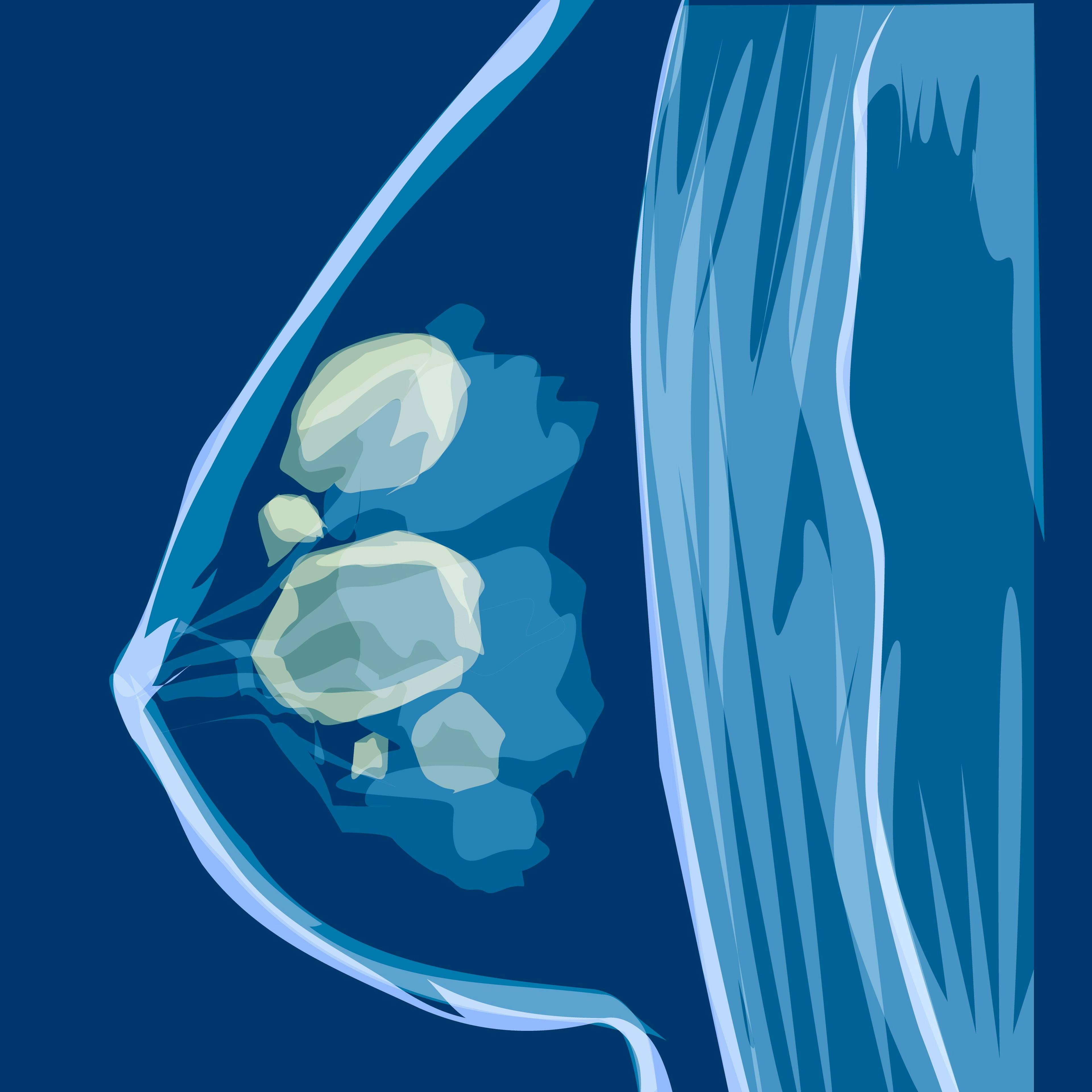 Breast cancer vector medicine illustration | Image Credit: enotmutant - stock.adobe.com