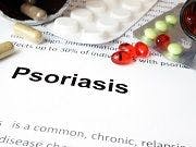 Psoriasis Drug Ilumya Launches in United States