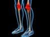 Hes1: A Genetic Target for Reversing the Pathogenesis of Osteoarthritis